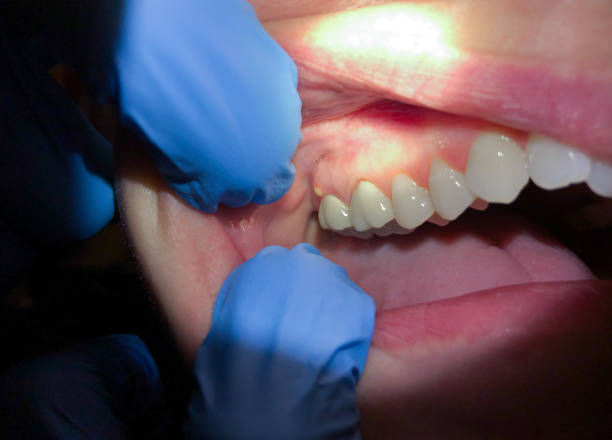 Best Root Canal Emergency Dentist  in Rosemead, CA